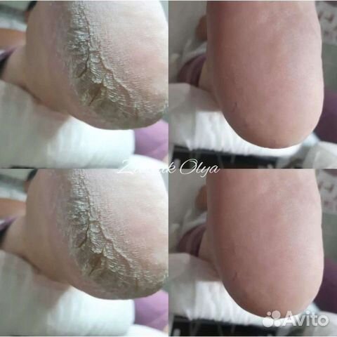 Подология,педикюр, маникюр